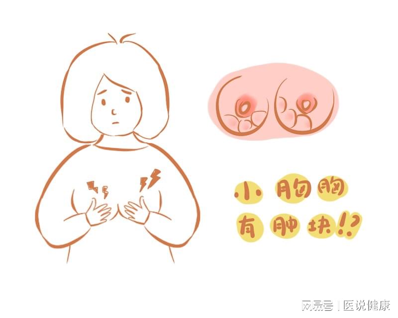 乳房长疙瘩没在意，检查竟是乳腺癌